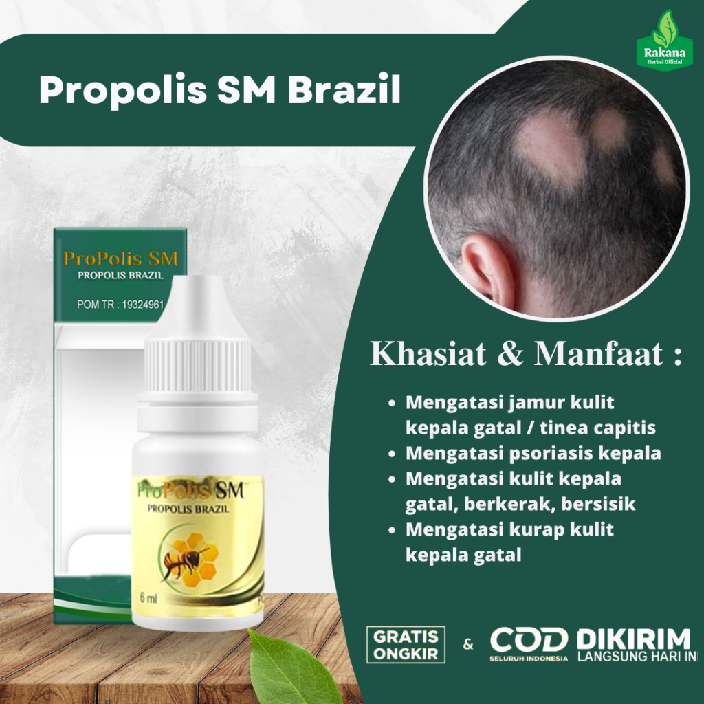 Obat Oles Jamur Di Kepala, Obat Kulit Kepala Berjamur, Obat Kurap Jamur Kepala, Obat Gatal Jamur Kul