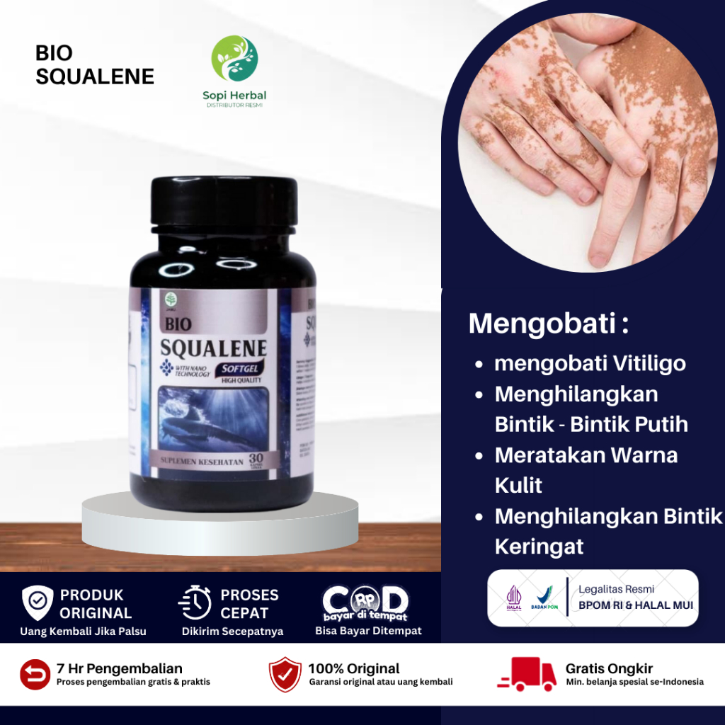 Obat Vitiligo di Wajah dan Lengan, Menghilangkan Vitiligo, Obat Pemudar Bercak Putih di Tubuh, Obat 