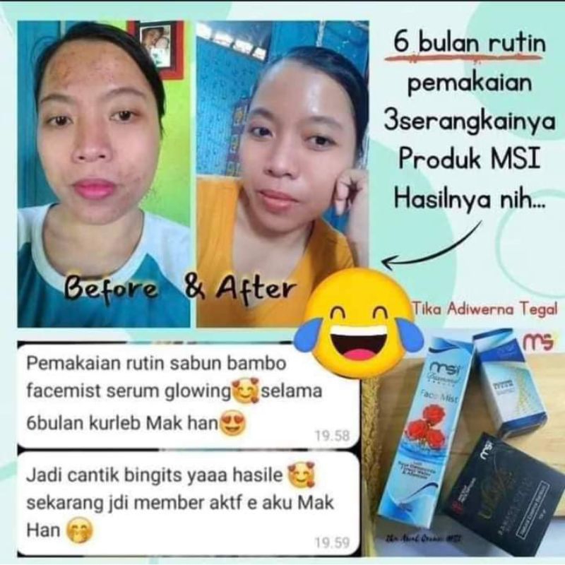 paket flek dan jerawat sabun Bambo glowing serum facemist diamond msi