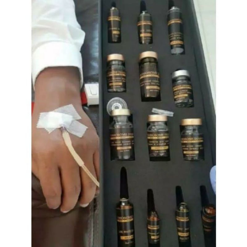 chromosome diamond/chromosome hitam