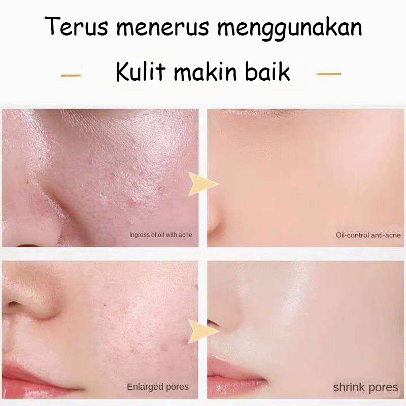 Amino Acid Ultra Gentle Cleansing Mousse 160ML Pembersih Wajah Facial Cleanser Sabun Muka Face Wash Foam Cleanser Mengencangkan pori-pori / mengelupas / memperbaiki warna kulit