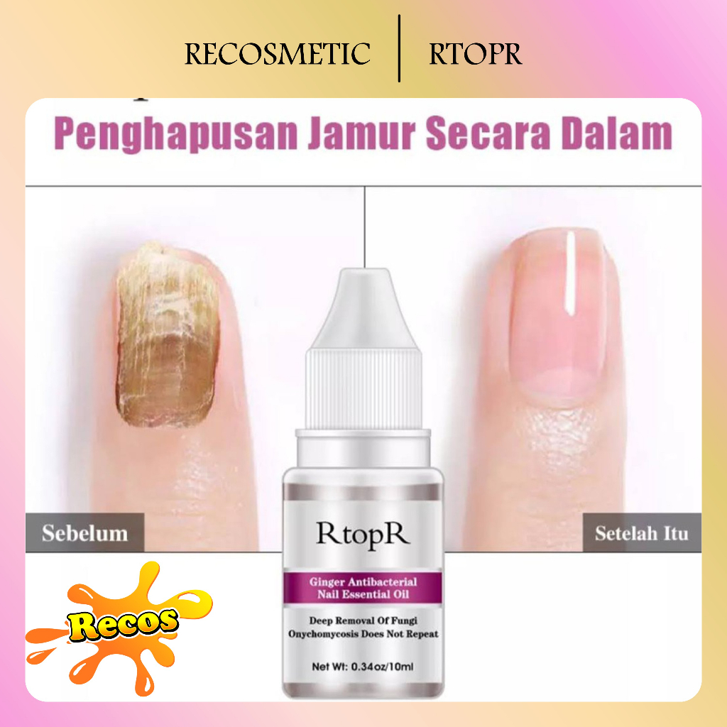 RtopR Ginger Antibacterial Nail Essential Oil Minyak Esensial Perawatan Kuku Jahe, Anti Jamur Infeksi Kuku Jari Kaki 10Ml