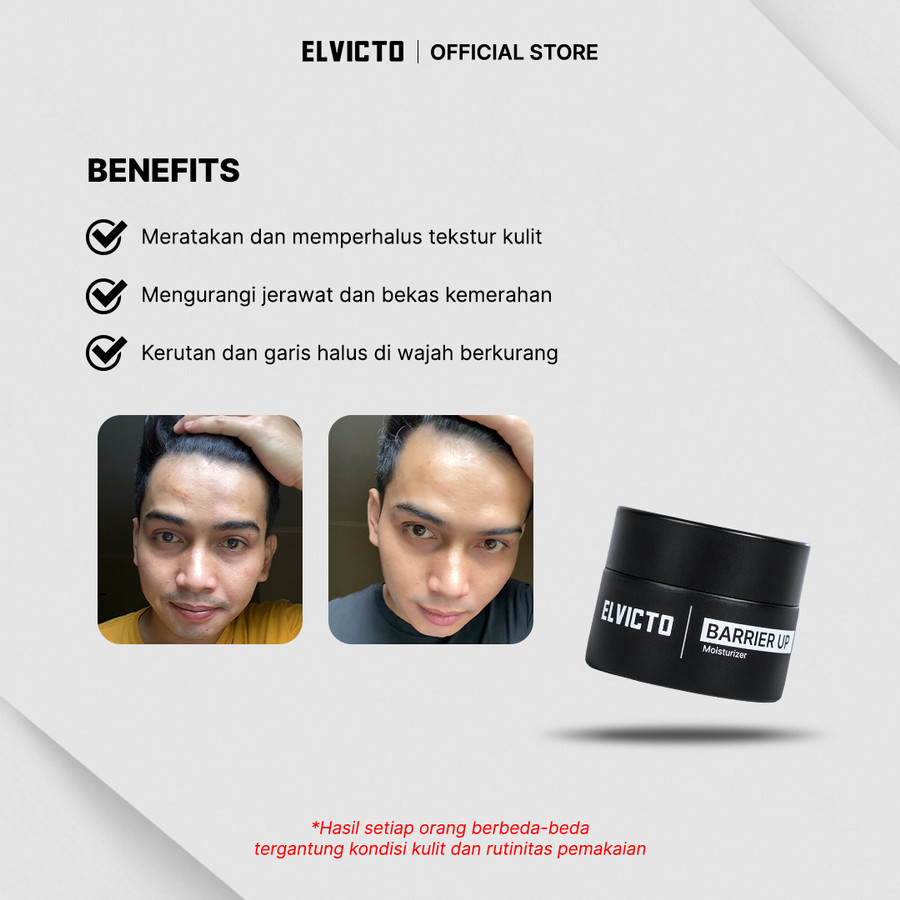 Elvicto Barrier Up Moisturizer 15 gr