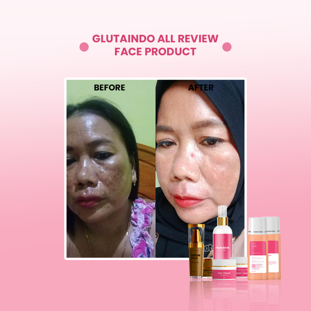 Glutaindo Face Serum Glowing Untuk Mencerahkan Dan Memperbaiki Skin Barrier