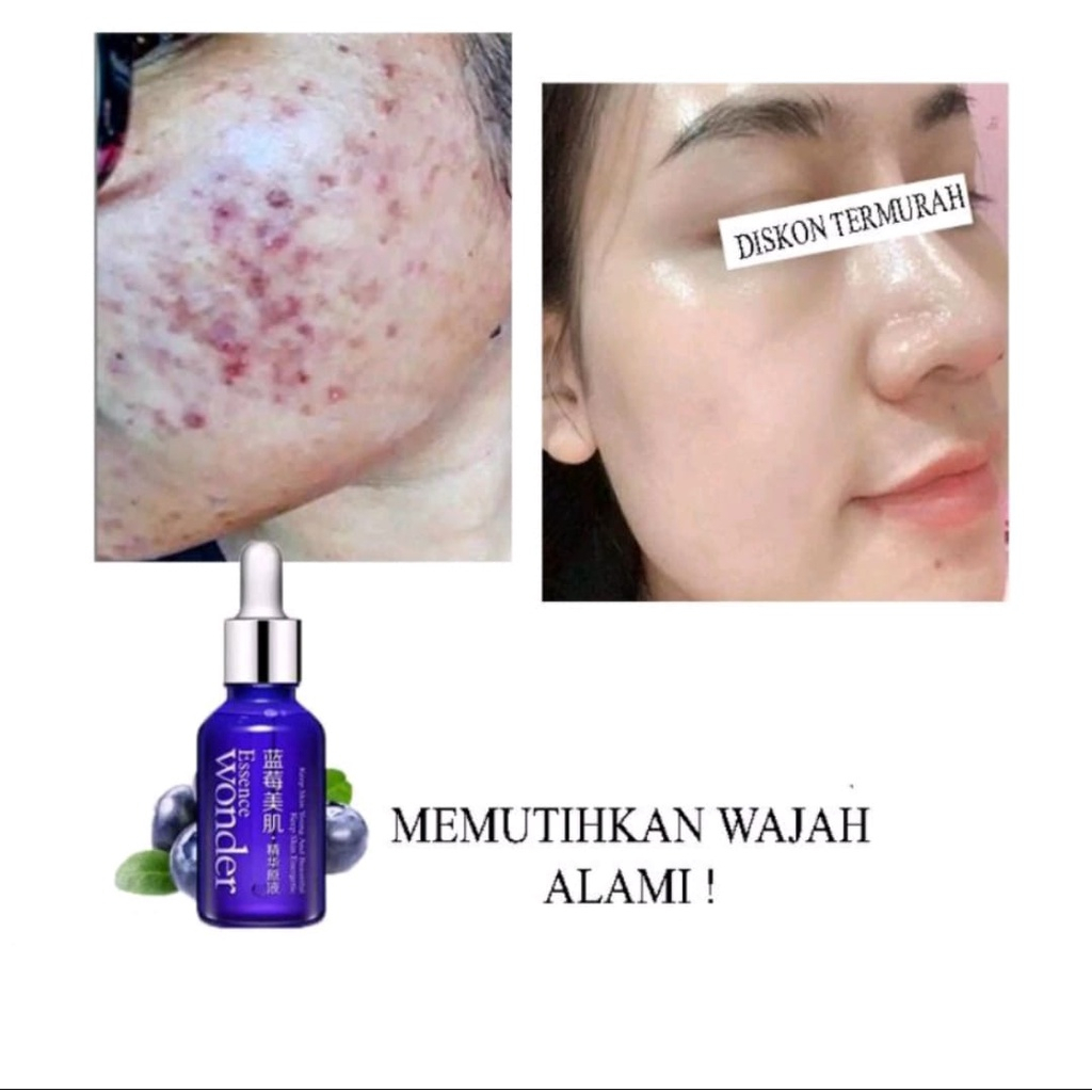 Blueberry Serum Flek Melasma Pemutih Wajah Extra Cepat Serum Glowing Penghilang Flek Membandel Penghilang Jerawat Serum Wonder Memutihkan