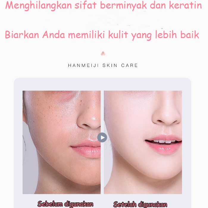 Amino Acid Ultra Gentle Cleansing Mousse 160ML Pembersih Wajah Facial Cleanser Sabun Muka Face Wash Foam Cleanser Mengencangkan pori-pori / mengelupas / memperbaiki warna kulit