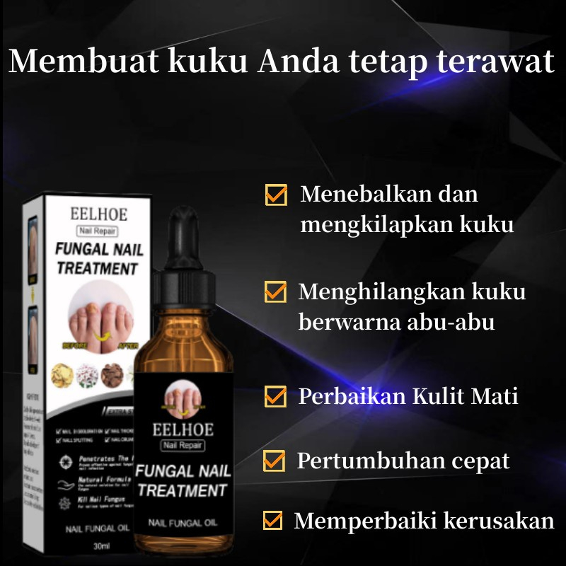 Obat Jamur Kuku Obat kuku jamur dan rusak Perawatan Kuku Berjamur Antibakteri Perawatan Kuku Onikomikosis Paronychia Anti Infeksi Kuku Toe Nail Pengobatan Jamur Minyak Nail Repair Essence Serum