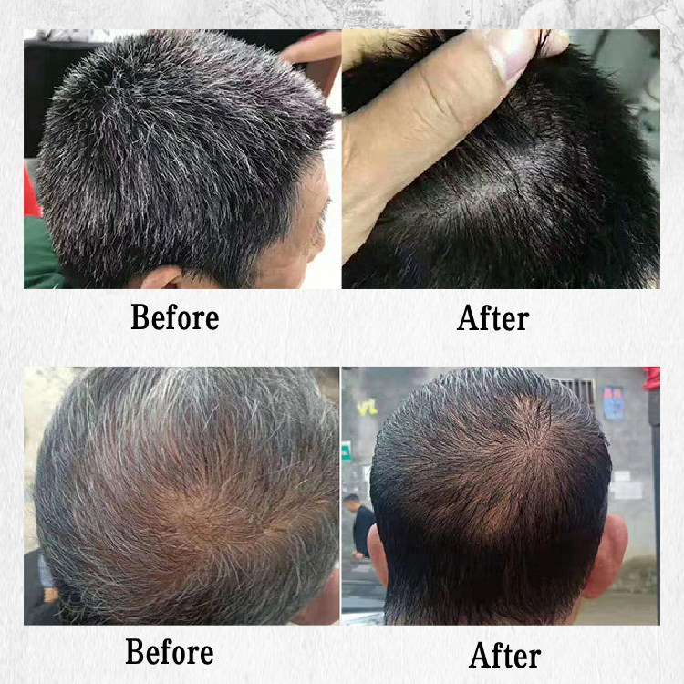 Mokeru Shampoo Pewarna Rambut Herbal Alami 500ml Shampo Penghitam Rambut Uban Menjadi Hitam Hasil Permanen 100% ORI