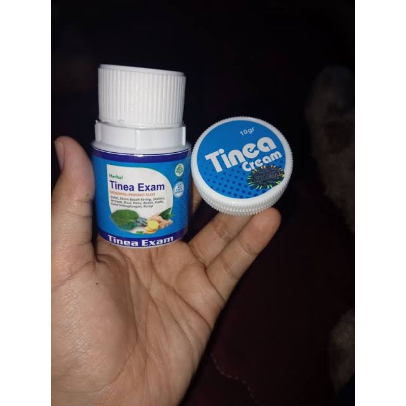 OBAT KULIT GATAL YANG MENAHUN.