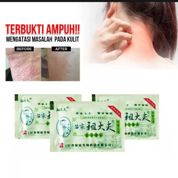 [10 Pcs] Salep Zudaifu Sachet Obat Herbal China Salep Kulit Panu Kadas Eksim - 3 Gram