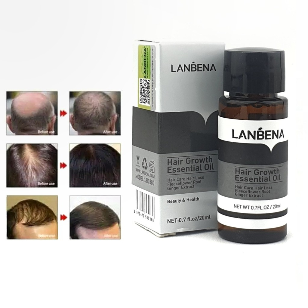 [ORI] Lanbena Serum Penumbuh Rambut &amp; Mencegah Kebotakan - Hair Growth Essential Oil 100% Original