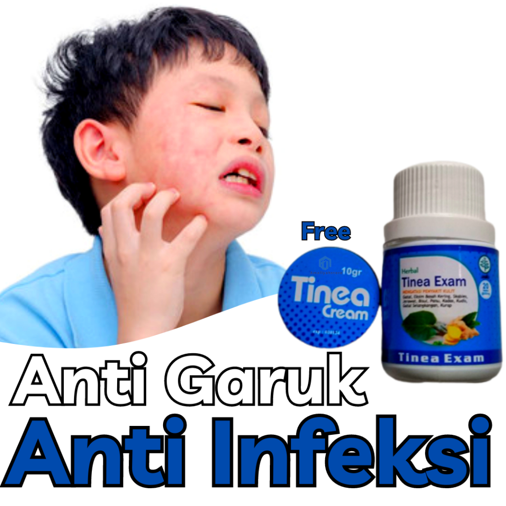 Tinea Exam Original Obat Kapsul Gatal-Gatal Ampuh Salep Krim Gatal Kulit Kadas Panu Eksim Menahun Di Kaki Selangkangan Pria Dan Wanita Paling Ampuh Permanen