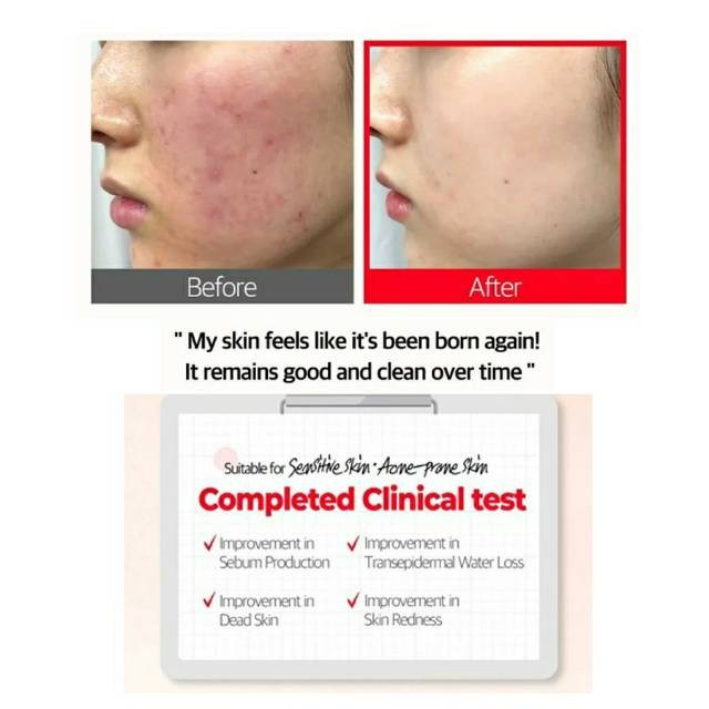 Somebymi Red Teatree Cicassoside Final Solution Serum 50ml EXP 06 2023