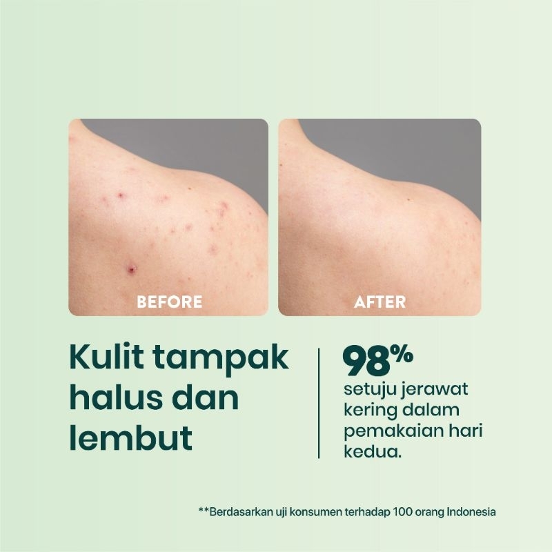 NPURE Cica Bacne Acne Clear Body Spray 50ml