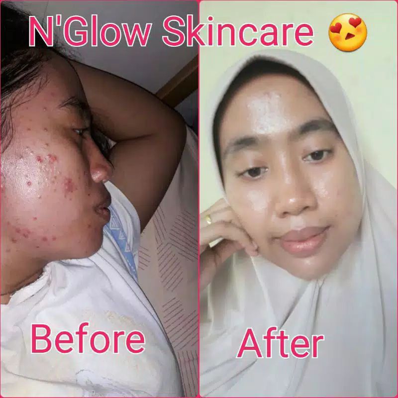 [GROSIR]N'Glow Skincare Paket Usaha Kecantikan Perawatan Wajah Ekonomis