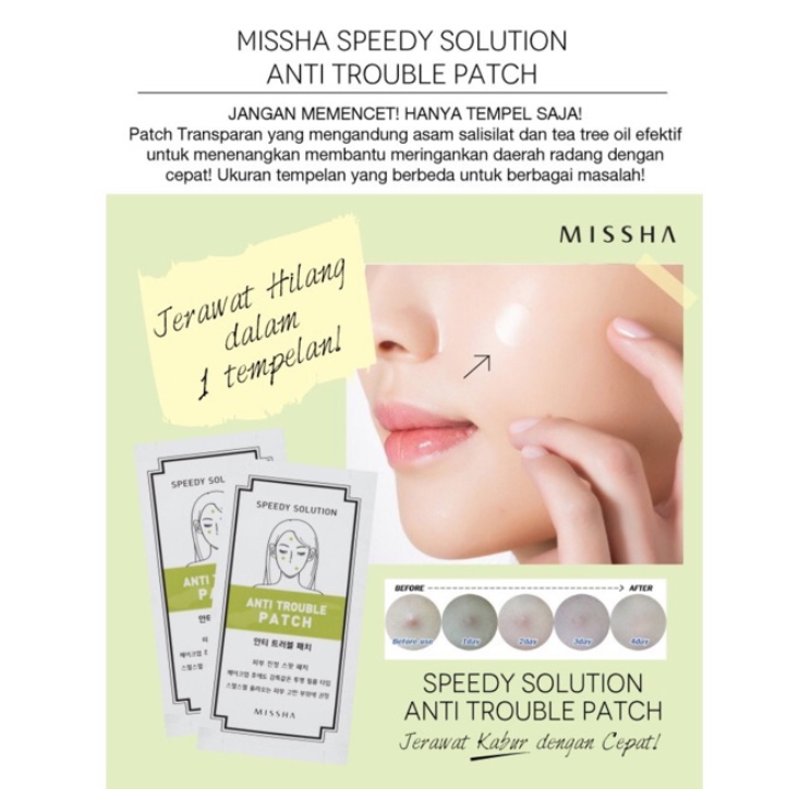 A534 MISSHA speedy solution anti trouble patch for acne | perawatan kecantikan wajah treatment jerawat spot patch bruntusan sticker tempel stiker bpom