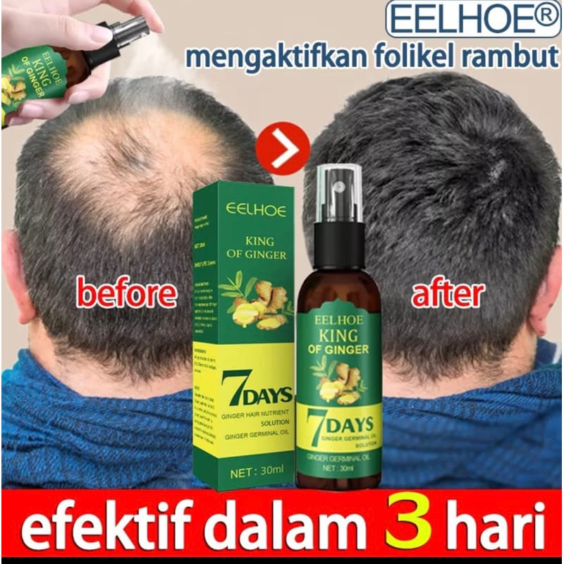 Hair Growth Serum Penumbuh Rambut Wanita Pria Secara Cepat / Penumbuh Rambut Botak / Rambut Rontok /