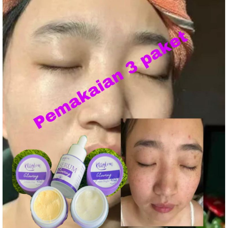 READY! KFSSGLOW SKINCARE ISI LENGKAP 5 MACAM - CREAM GLOWING KFS