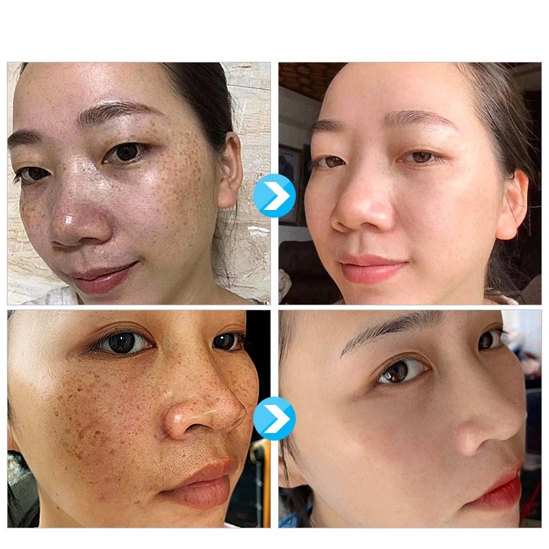 Pemutih wajah Serum pemutih wajah Night whitening salep flek hitam Penghilang flek hitam Salep Flek Hitam Melasma 100ML Secara efektif mengatasi flek hitam dan kulit hitam/Memutihkan kulit，memperbaiki kulit