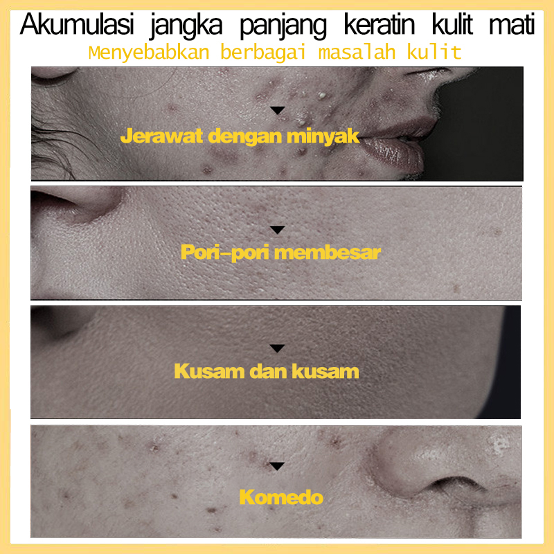 Scrub wajah Krim eksfoliasi wajah face scrub120g pemutih Pelembab kontrol minyak pembersih komedo mengecilkan poripori