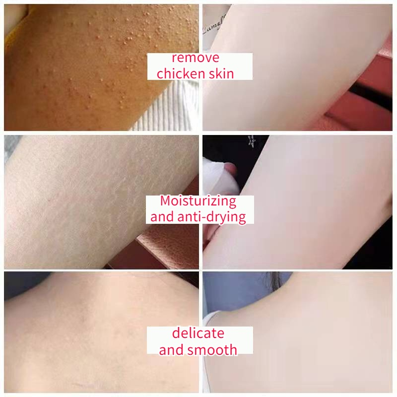 Sabun jerawat punggung ance Body wash Apsintus antibakteri sabun mandi 500ml Acne Shower Gel Aroma Alami Mengatasi Kulit Jerawat Kering