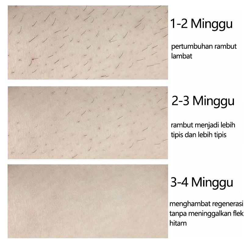 Perontok bulu permanen penghilang bulu ketiak hair removal spray krim penghilang bulu baju 150ML Painless Cepat/tidak iritasi/tidak ada flek hitam Seluruh tubuh tersedia