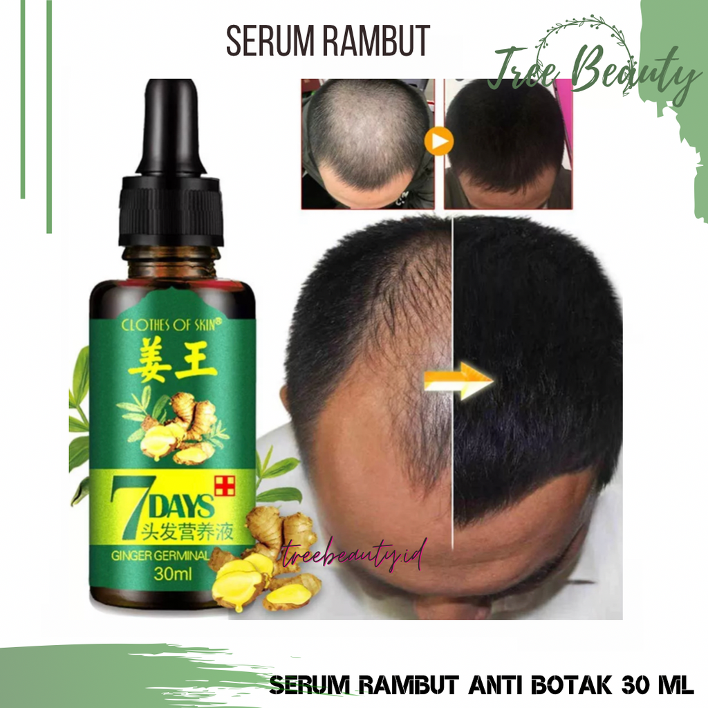 Essence Minyak Penumbuh Rambut Anti Rontok Obat kebotakan 7days Clothes Of skin Ginger