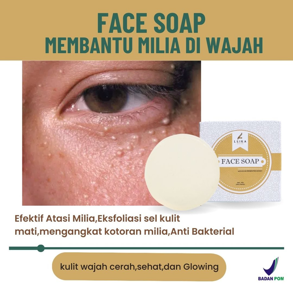 Ampuh Permanen Penghilang Milia Sabun Milia Wajah Ampuh BPOM Sabun untuk Milia di Bawah Mata Face so
