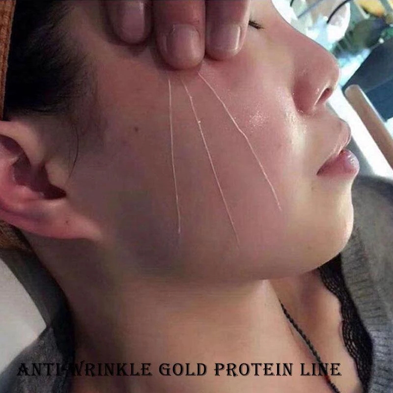 HIH Set Garis Kolagen Emas Anti-keriput Pemutih Benang Collagen Pengencang Wajah Tanam Benang Tanpa Jarum Gold Protein Line