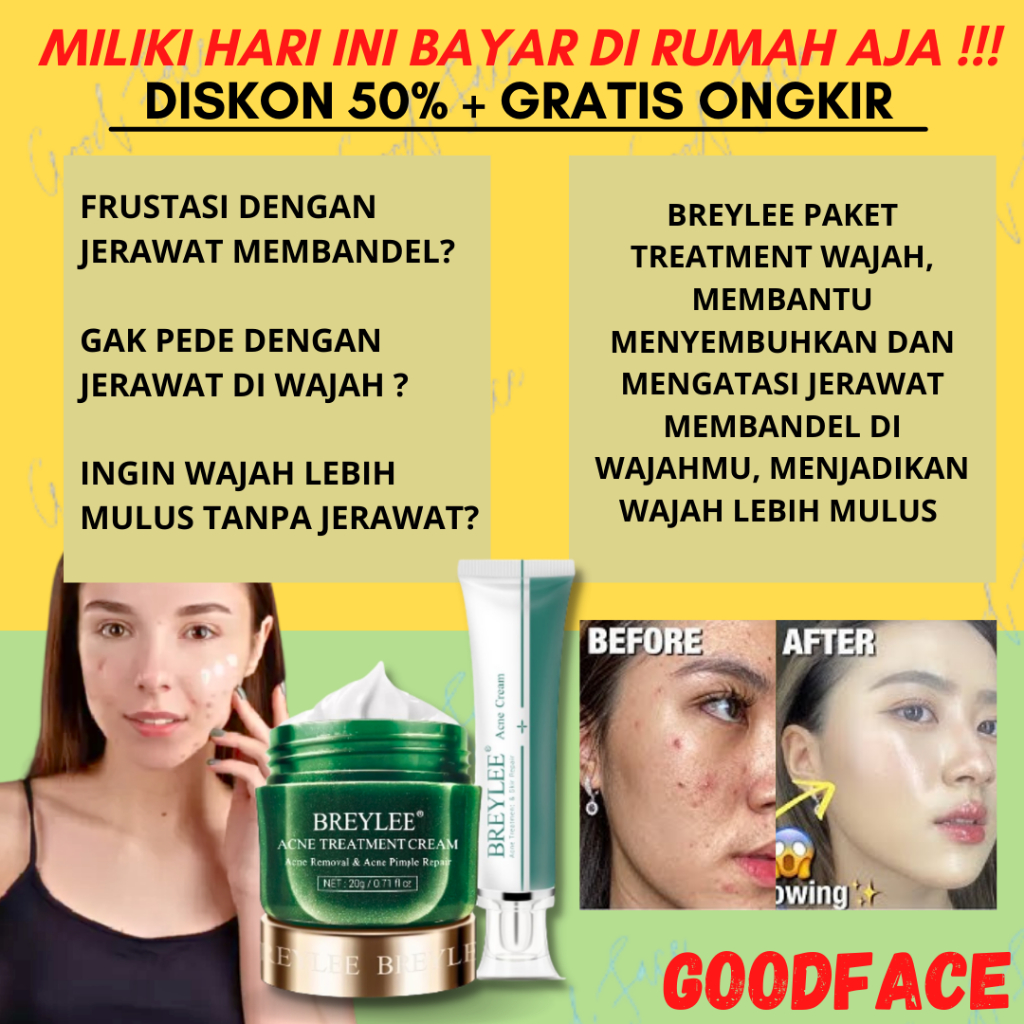 PENGHILANG JERAWAT BREYLEE Acne Cream Set Mengatasi &amp; Menghilangkan Noda Jerawat (2pcs)