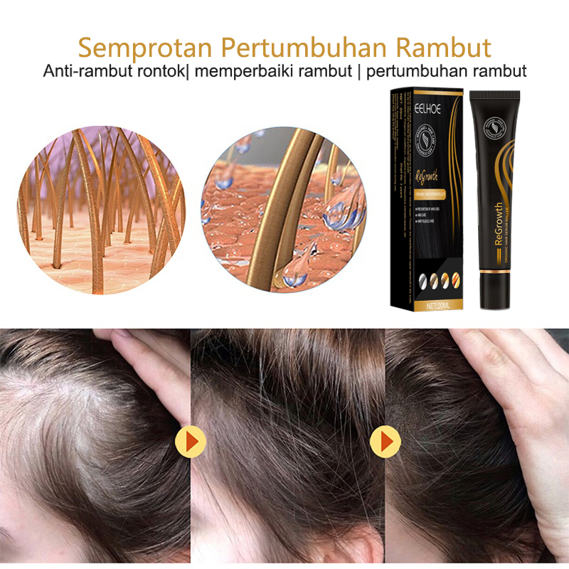 penumbuh rambut Hair growth serum penumbuh rambut botak serum penumbuh rambut 20ml serum rambut rontok Penumbuh Rambut Cepat