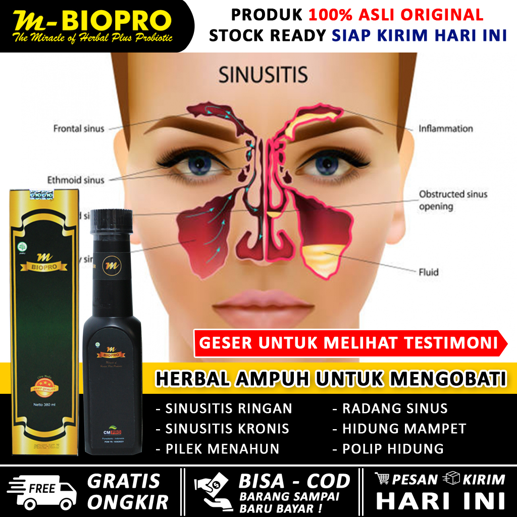 Obat sinusitis paling ampuh - sinusitis hidung semprot - sinusitis hidung bau busuk - sinusitis pile