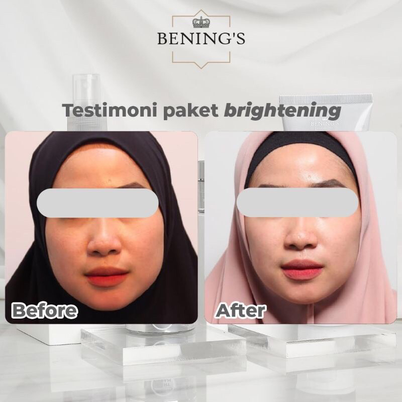 BENINGS SKINCARE DR OKY PRATAMA PAKET EXLUSIVE BRIGHTENING ACNE | BENINGS CLINIC | BENING'S SKINCARE