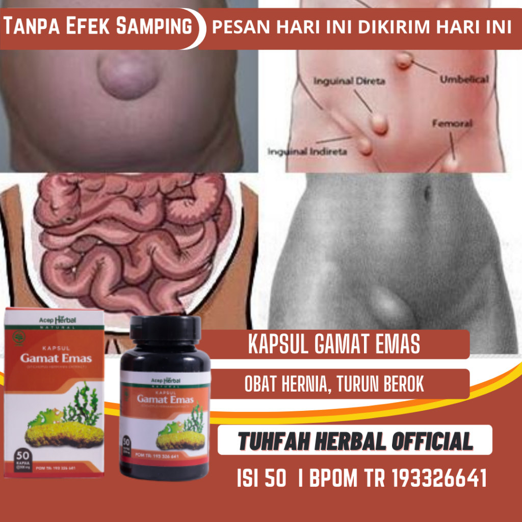 Kapsul Gamat Emas Asli Obat Turun Berok, Hernia, Turun Berok Pria, Varikokel Turun Peranakan, Turun 