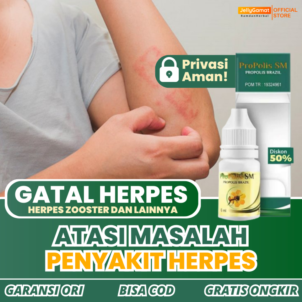 Obat Gatal Herpes - Obat Herpes - Obat Herbal Herpes - Salep Untuk Herpes - Propolis SM ASLI