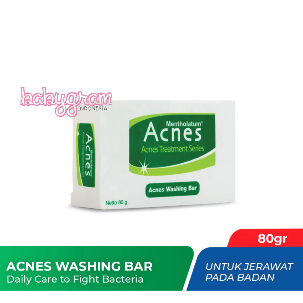 Acnes Washing Bar 80g Sabun Mandi Anti Jerawat Sabun Batang