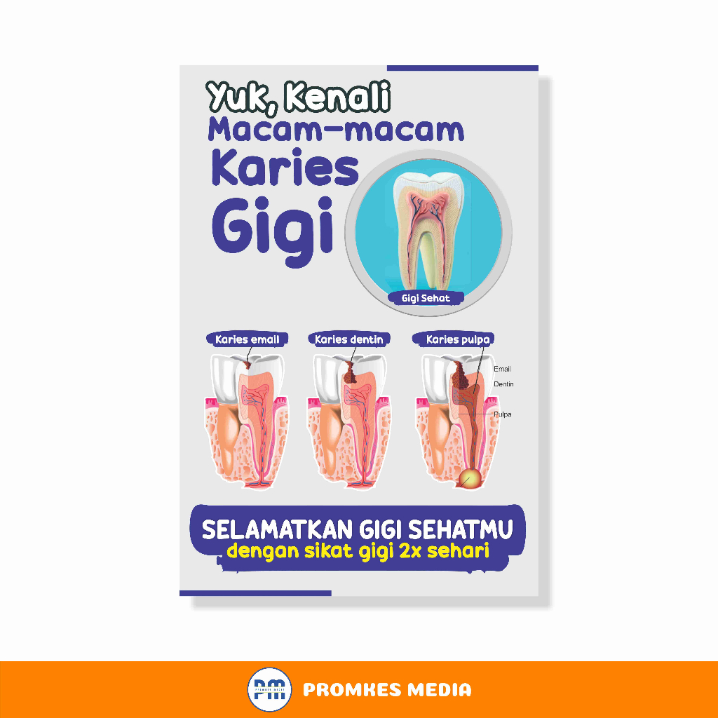 

Poster Kesehatan, Macam-Macam Karies Gigi