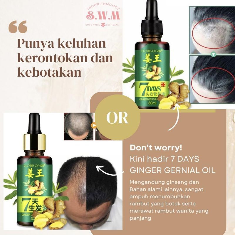 7 day obat penumbuh &amp; penebal rambut bayi dan dewasa menghilangkan rontok pada rambut penumbuhan rambut botak