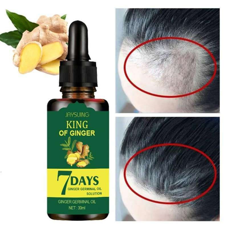 7 day obat penumbuh &amp; penebal rambut bayi dan dewasa menghilangkan rontok pada rambut penumbuhan rambut botak