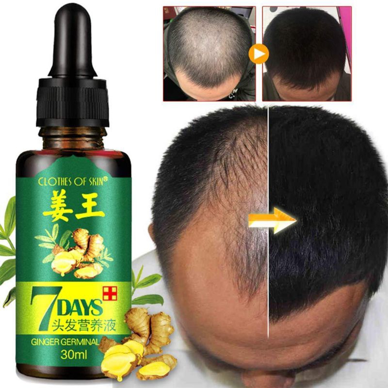 7 day obat penumbuh &amp; penebal rambut bayi dan dewasa menghilangkan rontok pada rambut penumbuhan rambut botak