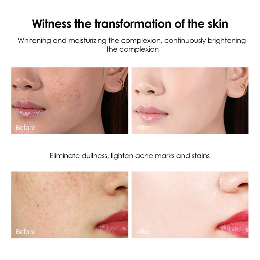 【COD】SK FI DIOR-SK Whitening Freckle Cream Remove Dark Spots Anti Freckle Cream Niacinamide Fade Pigmentation Melasma Brighten Creams concealer focallure【 Free Delivery+ COD + dikirim dalam 24 jam】