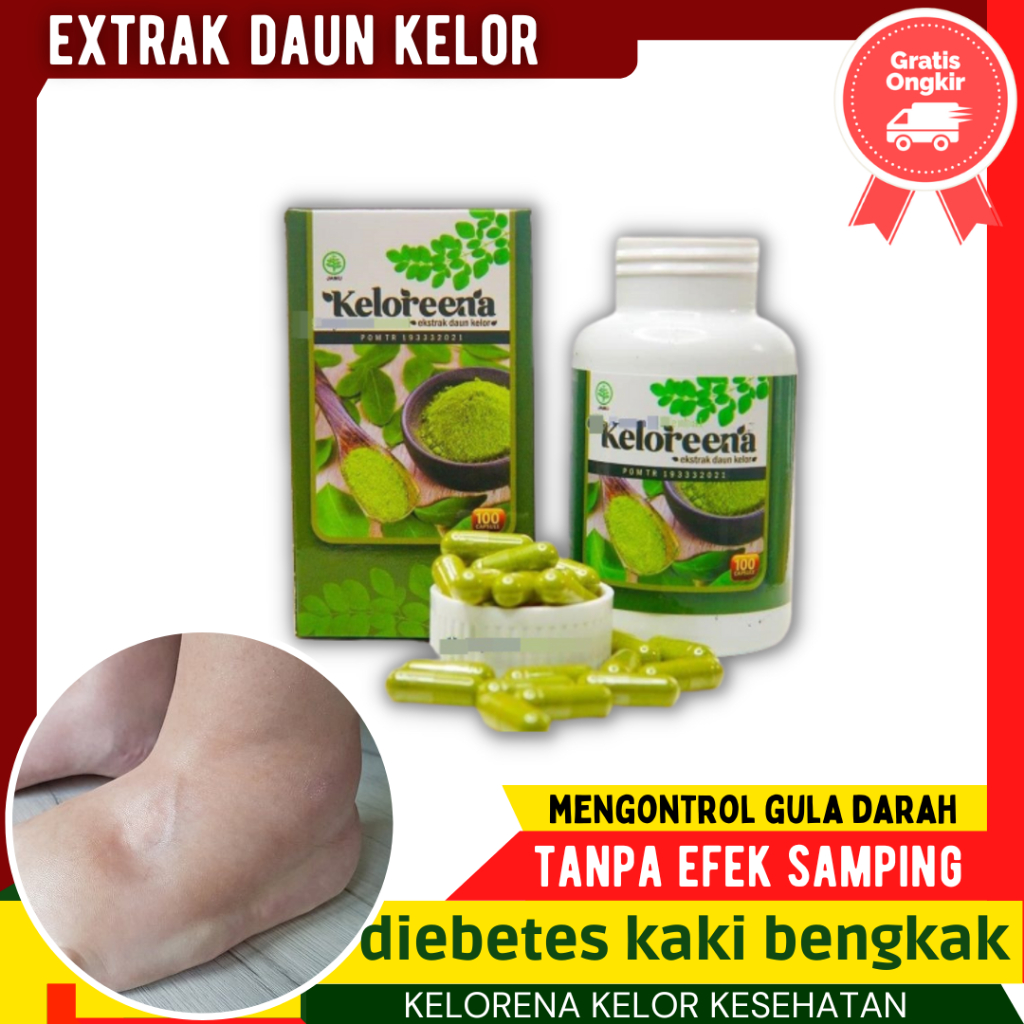 Obat Herbal Diabates Penurun Diabet Lansia - Gula Darah tinggi  Sampai kaki Bengkak [ Keloreena ]
