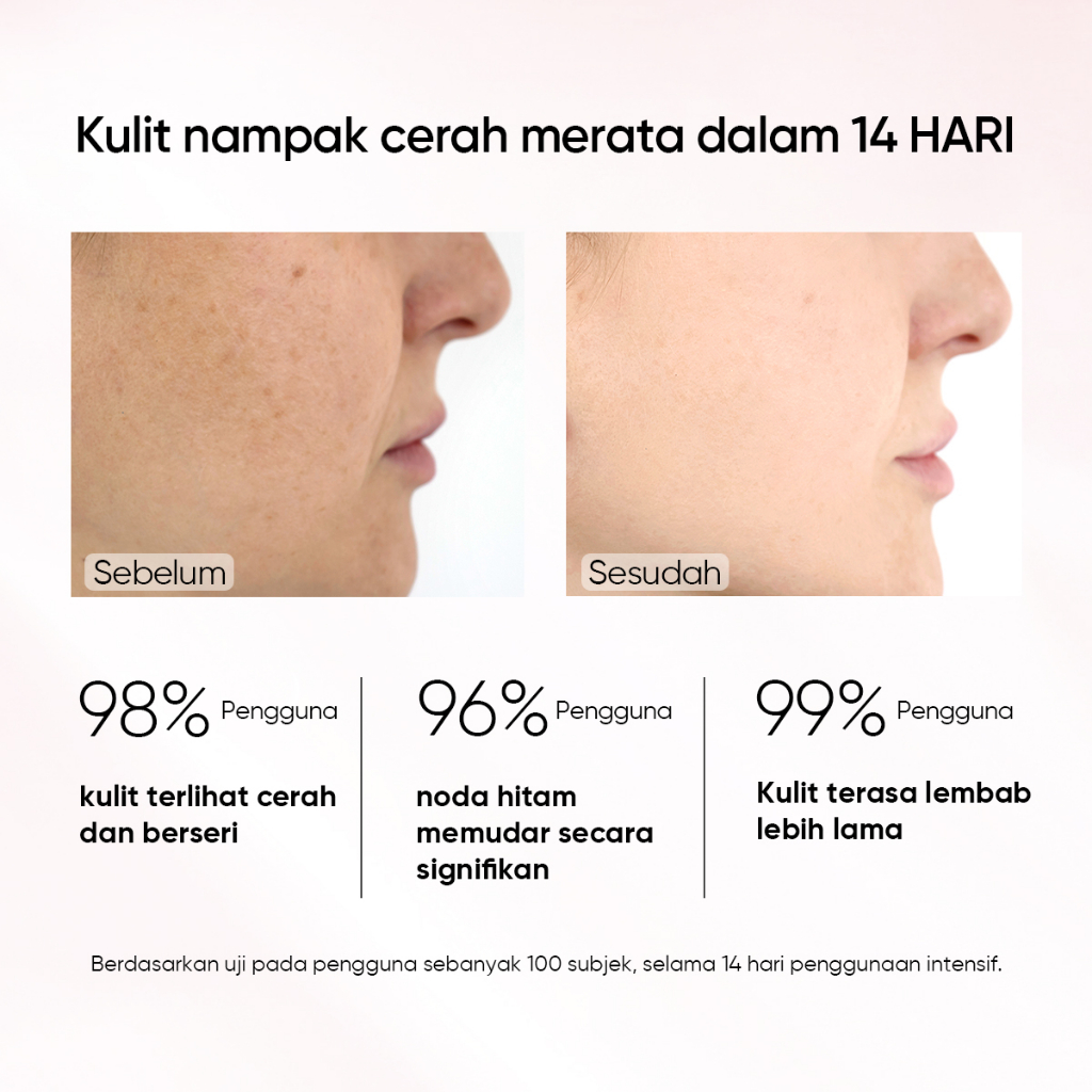 SKINTIFIC 2PCS Set Brightening &amp; Anti Dark Spot Paket Skincare Symwhite 377 Serum + MSH Niacinamide Moisuturizer Moisture Gel
