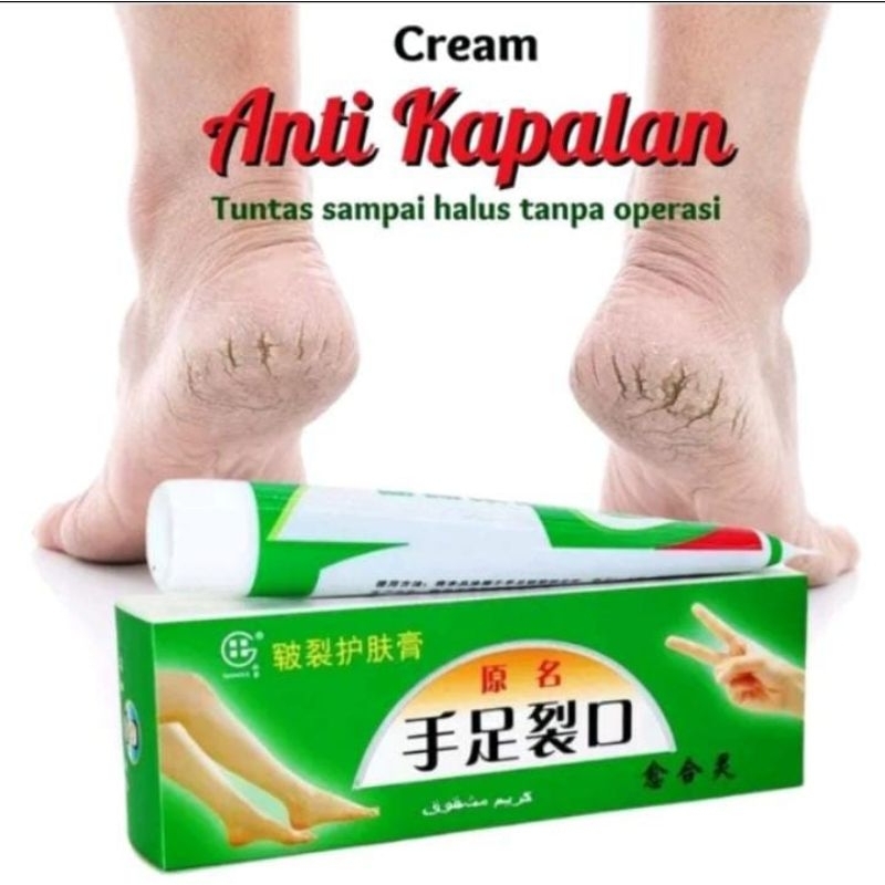 Salep Kaki TIANGE Atasi Tumit Kaki Tangan Eksim Pecah