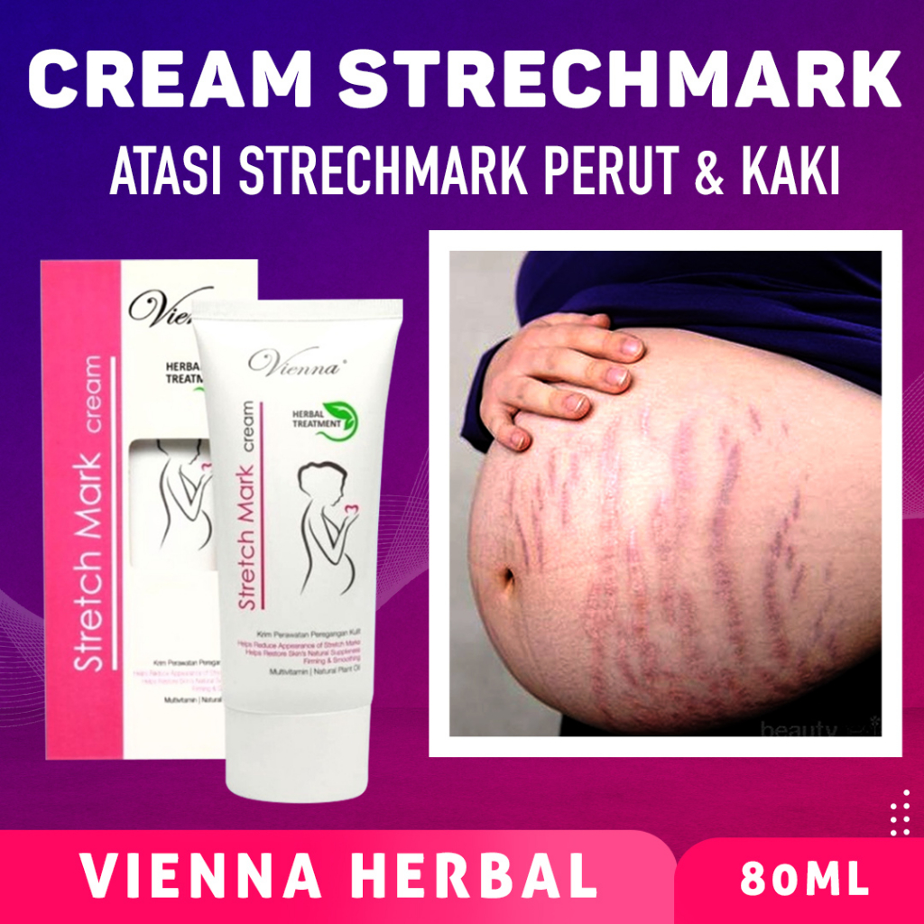 [TUBE] VIENNA STRETCH MARK CREAM 80 ML / STRECTH MARK CREAM