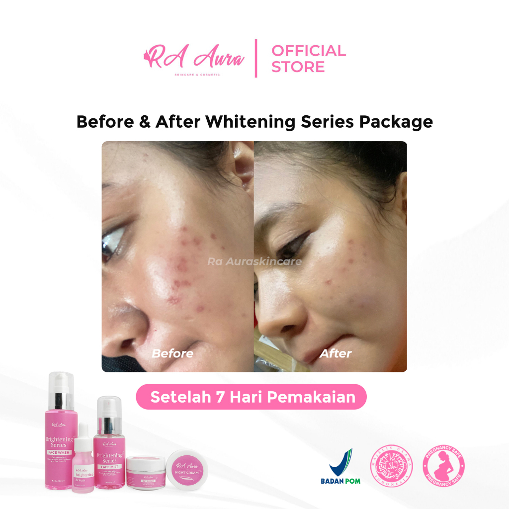 Ra Aura Whitening Day Cream / RETINOL / NIACIAMIDE / Paket Cream Pemutih / Cerah dalam 7 hari Cream Pemutih , Super Whitening , Glowing, Putih Cepat , DNA Salmon, Anti Aging, BPOM Ori, Kulit Kusam Sensitif Acne Jerawat Pelicin