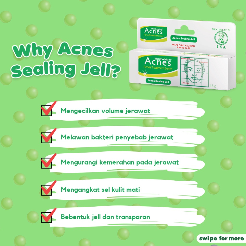 READY Acnes Sealing Gel / Acne Gel / Gel Jerawat / Acne Care | original