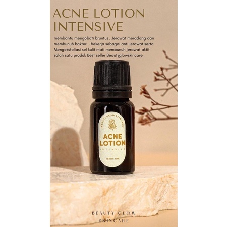 ACNE LOTION By BeautyGlow Skincare