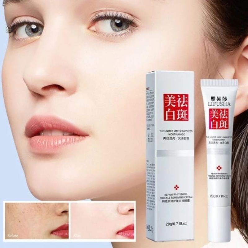 Whitening Freckle Cream Penghilang flek dan Bintik