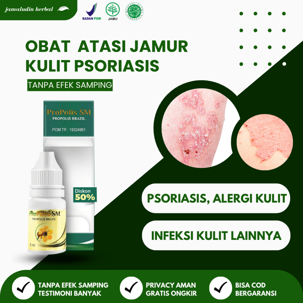 Obat Gatal Kulit - Obat Koreng Di kaki - Obat Gatal Gatal Pada Kulit - Salep Koreng Di Kaki